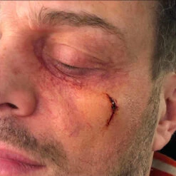 OCCHIO GONFIO Sinistro 5 OCCHIO GONFIO Sinistro -Trucco Di Halloween 800x800 stupr20013 occhio gonfio sinistro 2