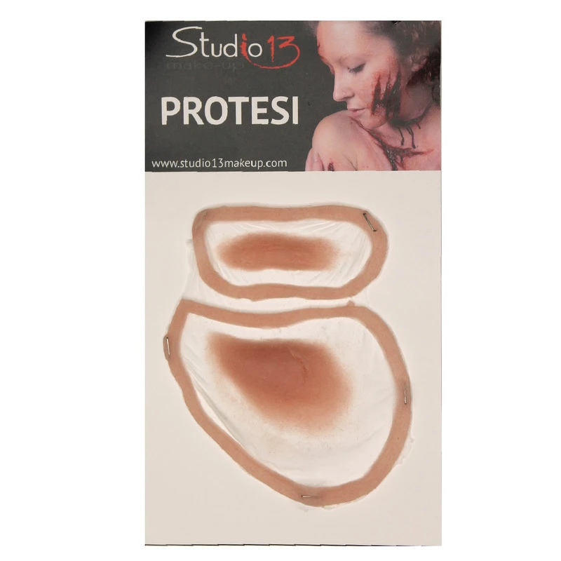 OCCHIO GONFIO Sinistro 1 OCCHIO GONFIO Sinistro